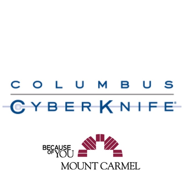 CyberKnife