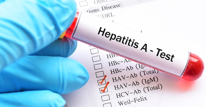 Hepatitis-A